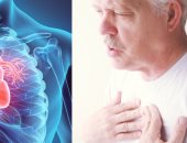 أمراض صمامات القلب تصيب أكثر من مليون إيطالى فى 2019