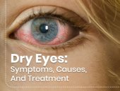 أسباب تقودك لجفاف العين.. أهمها جراحة الليزر ومرض السكر وبعض أدوية الاكتئاب