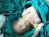طبيب يلقى طفل حديث الولادة وسط القمامة انجبه من علاقة غير شرعية مع عاملة بطنطا