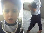 معاناة طفل بالشرقية.. وُلد بتشوه بالقدمين ويحتاج 15 ألف جنيه لعلاجه.. صور