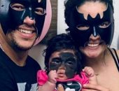 براءة وجه طفلة يختفي خلف قناع "باتمان" وشفاءها يحتاج لـ 100 عملية جراحية 
