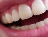 7 نصائح للحفاظ على صحة اللثة والأسنان.. منها التنظيف بالفرشاة والخيط 
