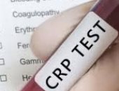 اطمن على نفسك.. تحليل "CRP" دليلك لكشف الالتهابات والعدوى