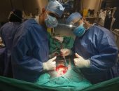 مستشفى مدينة نصر للتأمين الصحى يجرى جراحة نادرة بالقلب لمريض