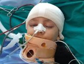 إصابة طفلة بغيبوبة بسبب انهيار جدار خلال هطول الأمطار