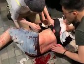 إصابة 4 أشخاص خلال هجوم بسكين فى هونج كونج.. وقطع أذن سياسى