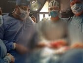 فريق طبي بمستشفى بنها الجامعي ينجح فى استئصال ورم يزن كيلو جرام من صدر مريض