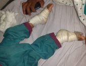 تضامن الشرقية تكشف تفاصيل تعذيب طفلة بأبوحماد و تقرر صرف معاش لها