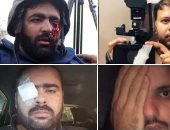 إعلاميون يتضامنون مع المصور معاذ عمارنة بعد فقد إحدى عيناه برصاصة إسرائيلية