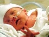 أسباب ولادة طفل مبتسر ومشاكل صحية يتعرض لها 