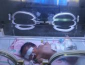 إنقاذ طفلة من الموت بعد ولادتها بأنف مسدودة بالمحلة.. صور
