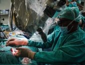 فريق طبى من جنوب أفريقيا يجرى أول عملية لزراعة الأذن الوسطى