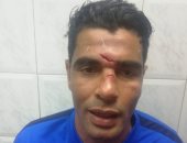 محمد صبحى حارس الداخلية يتعرض لجروح فى وجهه أثناء مباراة الترسانة