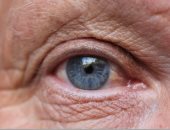 6 عادات صحية تمنع إصابتك بالضمور البقعى للعين