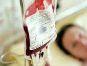 دراسة تكشف حقيقة صلاحية نقل الدم القديم للمريض