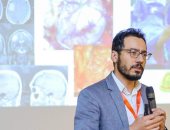 نجاح استئصال بؤرة صرعية بالمخ والمريضة مستيقظة بجامعة الزقازيق