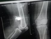 سبيها علينا.. وليد يناشد مسئولى جهاز العاشر بتوفير كشك له بعد عجزه عن العمل