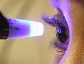 أمل جديد فى علاج أمراض العين.. العلماء ينجحون فى تجديد خلايا العصب البصرى