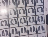 قارىء يطلب نقل والده إلى مستشفى متخصصة بالأورام فى بنى سويف