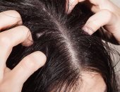 5 أسباب طبية لتساقط الشعر عند الأطفال
