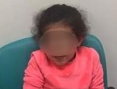 الإهمال ينهى طفولة عايدة بكسر عظامها فى نادى سبورتنج.. صور