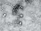 روسيا تسجل 21 ألفا و73 إصابة جديدة بفيروس كورونا و926 حالة وفاة