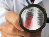 باختصار.. أهم الأخبار العربية والعالمية حتى الـ12 ظهرا.. إصابة 3 أشخاص فى قصف استهدف مبنى السفارة الأمريكية بالعراق.. أستراليا تعلن تسجيل خامس حالة إصابة بفيروس كورونا الجديد.. وزلزال يضرب جزر سولومون