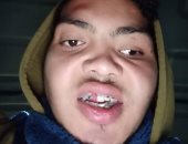   سيبها علينا .. والد طالب جامعى بالشرقية تعرض لكسور بالجمجمة والوجه يناشد بعلاجه