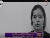 "مساء DMC" يعرض تقريراً لتوعية "مؤسسة أهل مصر" بمخاطر التنمر بضحايا الحروق.. فيديو