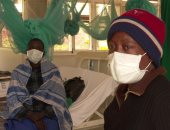 تاريخ الأوبئة.. ما فعله السل في العالم 