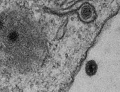 اكتشاف فيروس غامض لا يملك جينات يحير العلماء بالبرازيل 