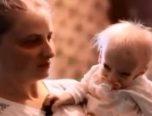 وفاة "الطفلة الأوكرانية المسنة" المصابة بمرض الشيخوخة المبكرة