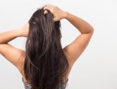 وصفات طبيعية لعلاج قشرة الشعر .. من الزيوت طبيعية للأكلات الصحية