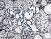 صورة مجهرية تكشف كيف غزت جسيمات كورونا الفتاكة خلايا المريض الأمريكي صفر  