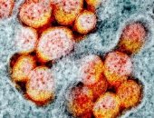 البرتغال تسجل أول حالة وفاة بفيروس كورونا