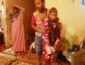 مأساة "منة الله" مصابة بسرطان وضمور فى المخ بالغربية.. صور