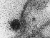 شاهد اللحظة التى يهاجم فيها كورونا خلايا الجسم السليمة تحت الميكروسكوب