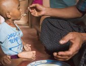 الأمم المتحدة: الركود العالمي يهدد بوفاة 300 ألف طفل