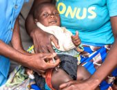  لوسيتانا أول طفلة تتلقى لقاح الملاريا.. اعرف التفاصيل 