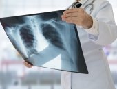 ما هى الأشعة السينية للصدر وكيف تستعد لإجراء الفحص؟