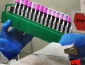 باحثون أستراليون يبتكرون اختبار دم للكشف عن الإصابة بكورونا فى 20 دقيقة