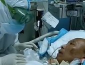 أطباء ووهان ينقذون مريضا تدهورت حالته بعملية زراعة رئة مزدوجة.. فيديو