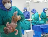 مستشفى إسنا للعزل الصحى تجرى الولادة الرابعة لسيدة مريضة بكورونا.. صور
