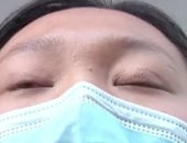 صينية لا تستطيع النوم إلا بغلق عينيها بـ"شريط لاصق" بعد جراحة تجميلية فاشلة