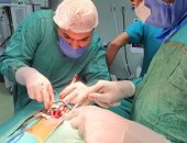 صور.. أطباء مستشفى أرمنت ينقذون طفلة 8 سنوات من صديد على الجهاز التنفسى