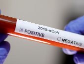 إصابة أمير بلجيكى بكورونا بعد حضوره حفلا فى إسبانيا