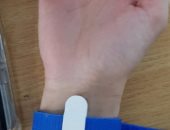 علماء يطورون ساعة يد لمرضى متلازمة توريت تصعق مستخدمها للتحكم فى تشنجاته