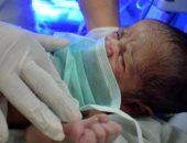 المستشفيات التعليمية تعلن ثالث حالة ولادة لمصابة بكورونا بمستشفى الساحل 