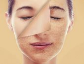 5 مقشرات طبيعية للجسم للتخلص من البشرة الجافة.. العسل والملح أبرزها