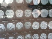 أب يستغيث لإنقاذ حياة ابنه الرضيع بسبب نزيف فى المخ